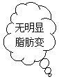 云形标注: 无明显脂肪变