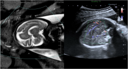 1635340807118247.png image.png