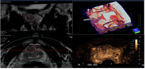 1635340815110793.png image.png