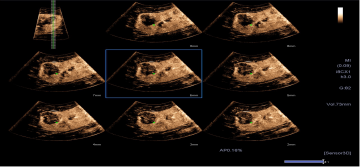 1635340892674221.png image.png