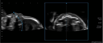 1635340956203712.png image.png