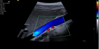 1635603025830900.png image.png