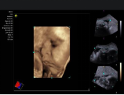 1635688838411297.png image.png