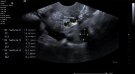 1635688863127649.png image.png