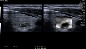 1635860303762092.png image.png