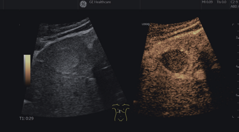 1639205542166791.png 8846c24c6260529885171ba4044d69e.png