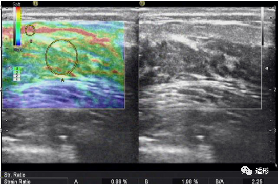 1682066487642464.png 51a080c3670e3ca7a03753333b747f9b.png