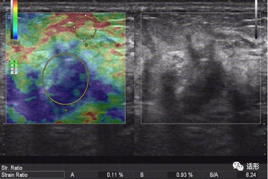 1682066496899536.png e1af24bd127398a9be971169a9904e35.png