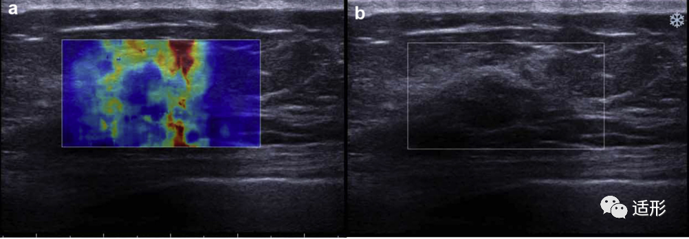 1682066506829265.png 1cd1ade0e5bd411f256ef8fdc891c88b.png