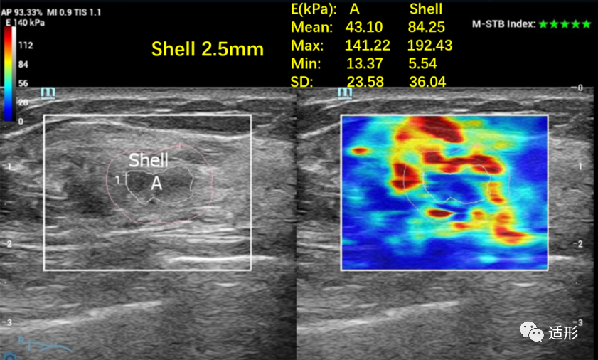 1682066515868510.png 722436b76fa7f5272aa048dd90d18215.png