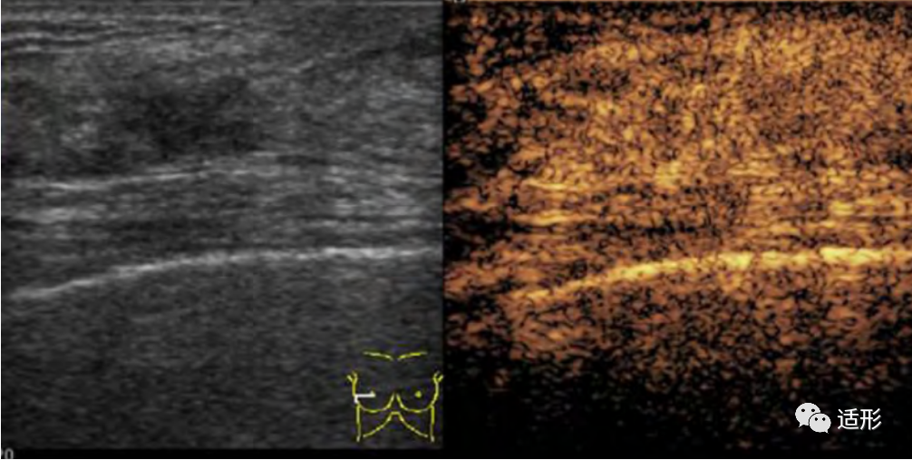 1682066528529420.png cb0f6452c0dd630f8ef46c168e99789b.png