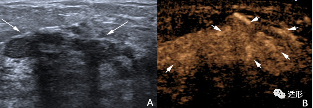 1682066538112149.png ae8345717d0967148323cf83324b6a6c.png