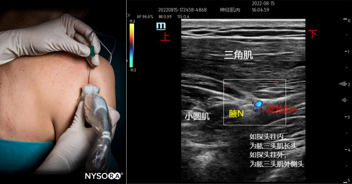 1688915568435739.png 1688915559016.png