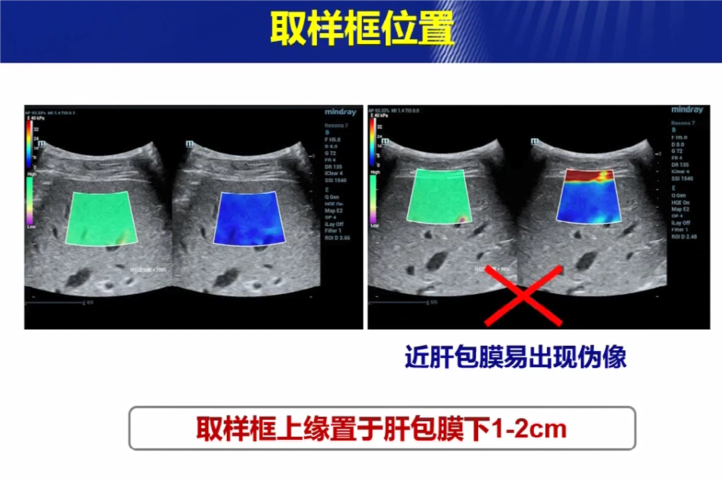 名家论弹+吴曼丽[00_10_41][20230809-223808].png