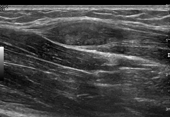 1700362589320758.png 77748be57a645aa543f118d1e0c4319d_640_wx_fmt=png&wxfrom=5&wx_lazy=1&wx_co=1.png