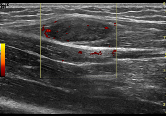 1700362595918169.png 79392adaffbcbe12f8a72d99e674159f_640_wx_fmt=png&wxfrom=5&wx_lazy=1&wx_co=1.png