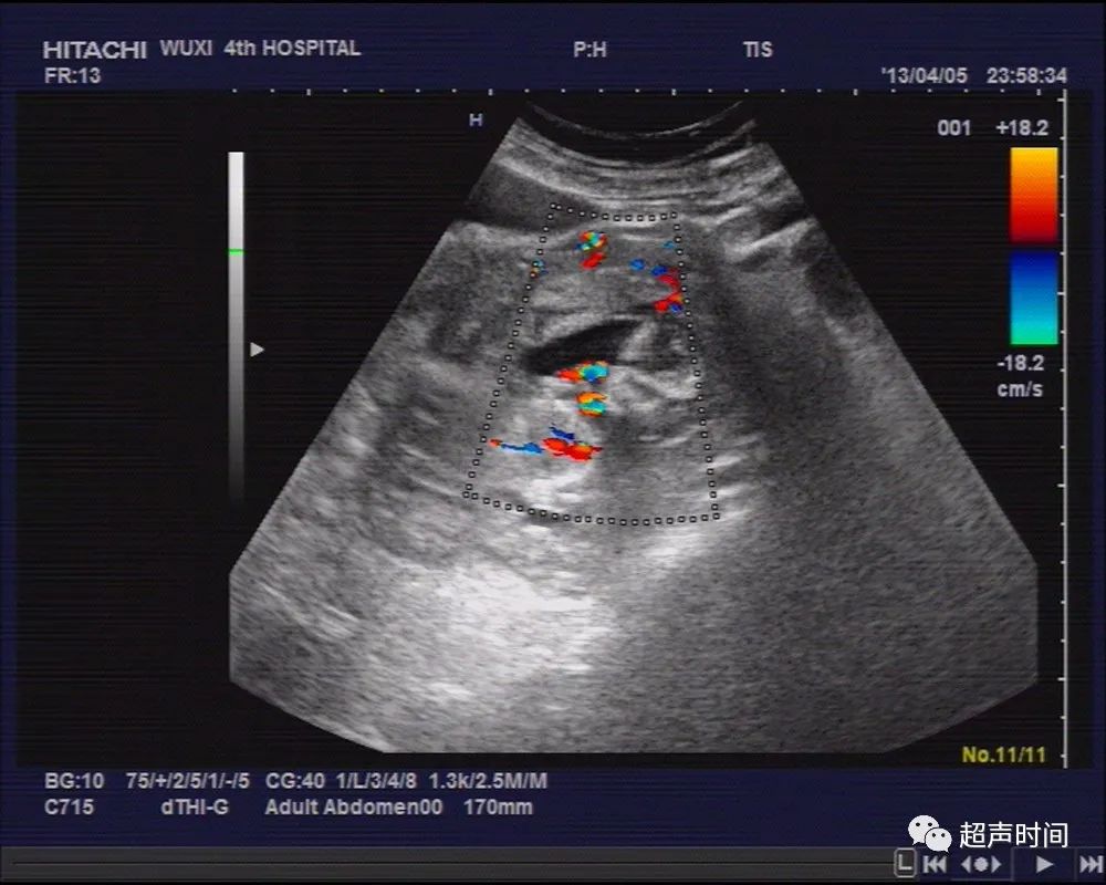 1700366841339735.jpg 97c38916a5e14a89f275f146d1b628df_640_wx_fmt=jpeg&wxfrom=5&wx_lazy=1&wx_co=1.jpg