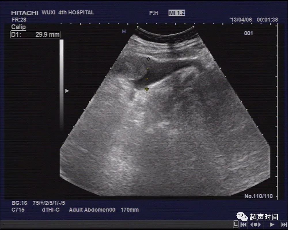 1700366849564835.jpg 77f8498842062e2336354149d62fd4f4_640_wx_fmt=jpeg&wxfrom=5&wx_lazy=1&wx_co=1.jpg