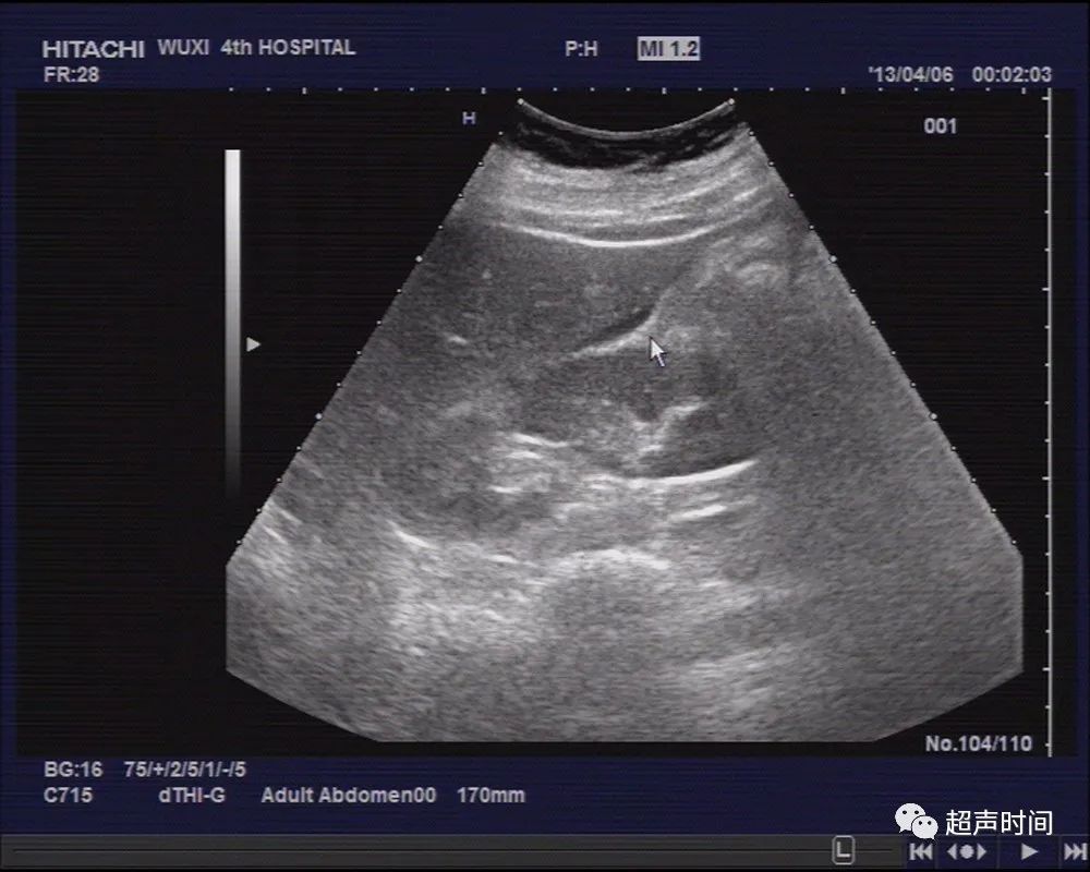 1700366896135696.jpg 2dc4a936fe13661a514c9f2de244abe7_640_wx_fmt=jpeg&wxfrom=5&wx_lazy=1&wx_co=1.jpg