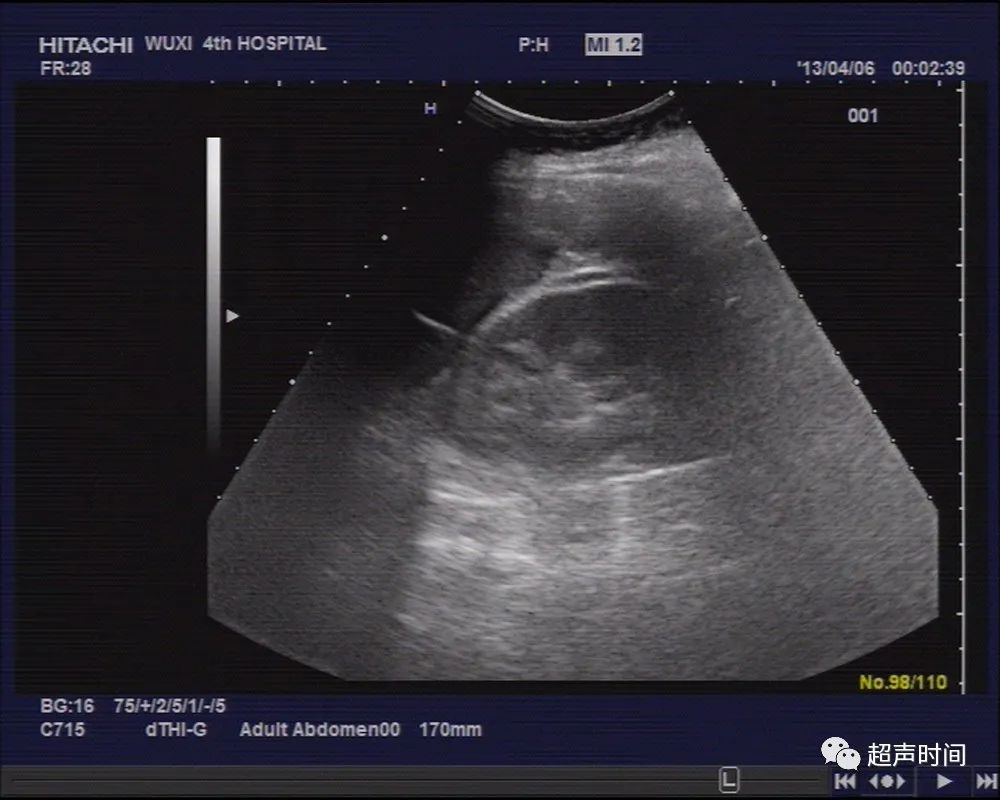 1700366906126513.jpg a2785295d4ef4f7a88ae31e8ea4ac18e_640_wx_fmt=jpeg&wxfrom=5&wx_lazy=1&wx_co=1&retryload=4.jpg