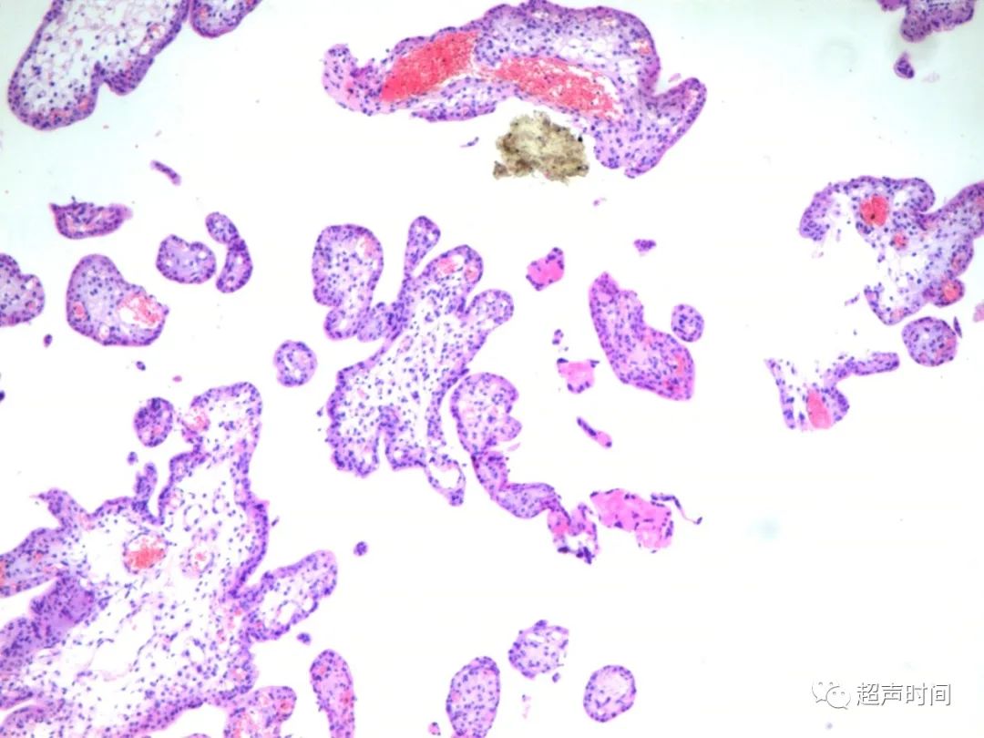 1700366914101124.jpg 20ed381206394e2f7c847870fee95d86_640_wx_fmt=jpeg&wxfrom=5&wx_lazy=1&wx_co=1.jpg