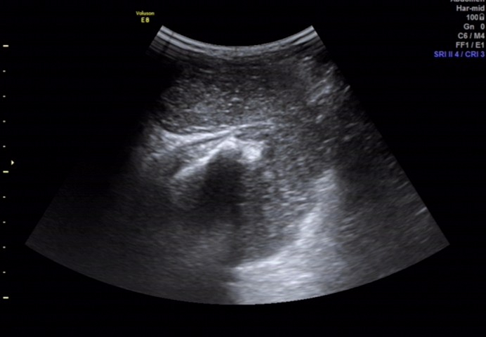 1700367158111615.png 828c65c9c7d5cd488f7fcf418cb22c21_640_wx_fmt=png&wxfrom=5&wx_lazy=1&wx_co=1.png