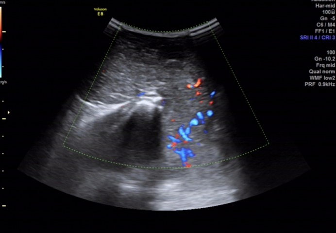 1700367166773238.png 394afc160a379785ddfb2743a2be5d3f_640_wx_fmt=png&wxfrom=5&wx_lazy=1&wx_co=1.png