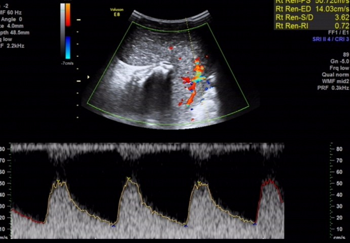 1700367176191491.png 659c97ee2e0d83be7bd4e793adec84bd_640_wx_fmt=png&wxfrom=5&wx_lazy=1&wx_co=1.png