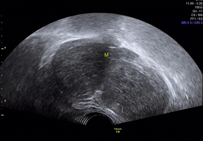 1700367241146394.png 921d257dd9f1f84e1323bf30d9c191cd_640_wx_fmt=png&wxfrom=5&wx_lazy=1&wx_co=1.png