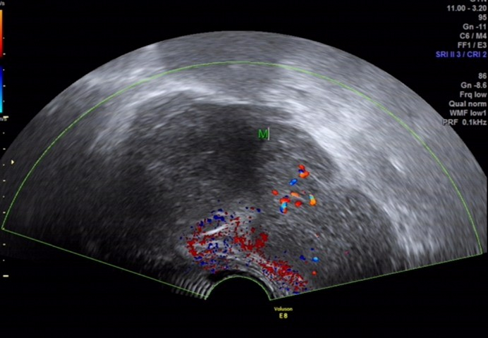 1700367250128755.png 3a45cc26222611288b3d321cb09f336b_640_wx_fmt=png&wxfrom=5&wx_lazy=1&wx_co=1.png