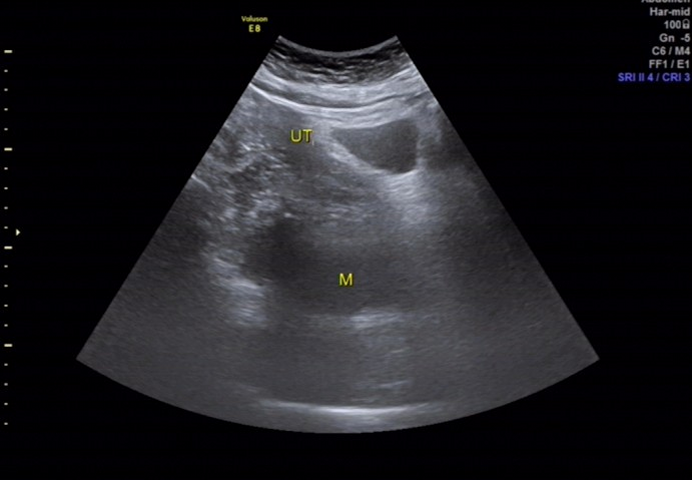 1700367259339477.png 5098ebf17e278b0eb0382044379f311a_640_wx_fmt=png&wxfrom=5&wx_lazy=1&wx_co=1.png